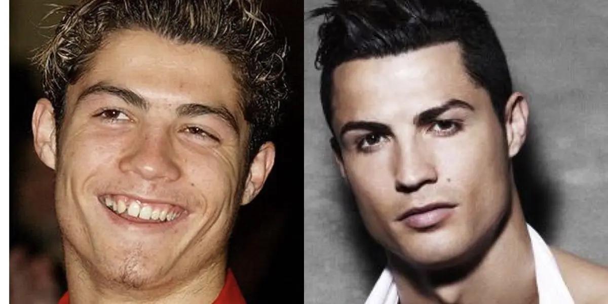 Cristiano Ronaldo's looks have changed over the years, with many rumours that he has undergone numerous plastic surgeries. A cosmetic surgeon points out the evidence.
