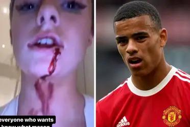 Mason Greenwood is in trouble over controversial allegations after his girlfriend, Harriet Robson, posted several photographs on her Instagram profile with serious injuries that the Manchester United player allegedly caused her.