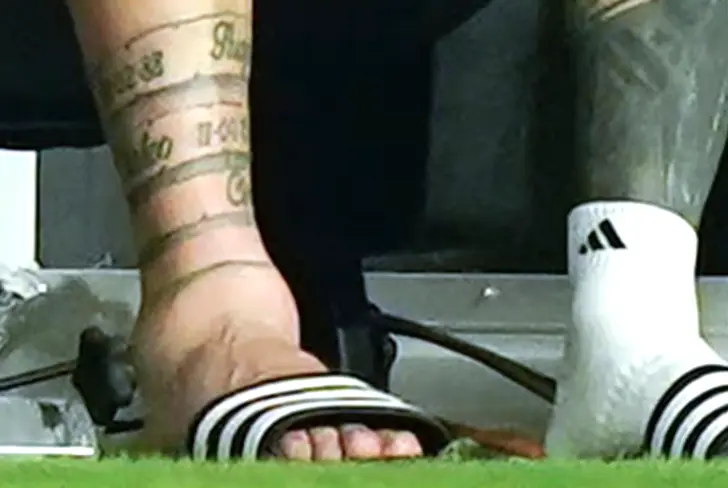 Messi's ankle